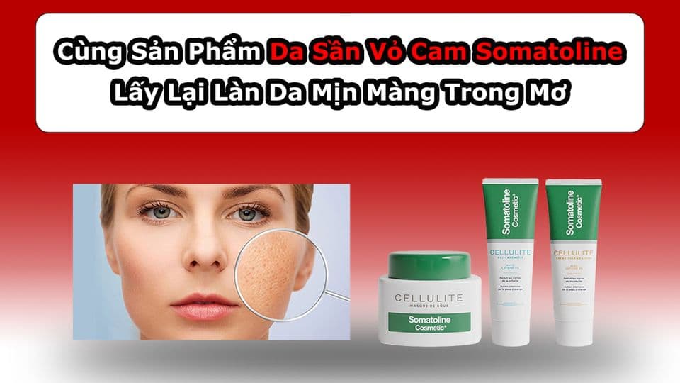Review Kem Trị Da Sần Vỏ Cam Somatoline Được Chị Em Tin Dùng
