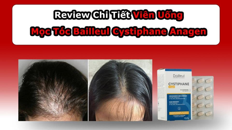 Review Viên Uống Mọc Tóc Bailleul Cystiphane Anagen