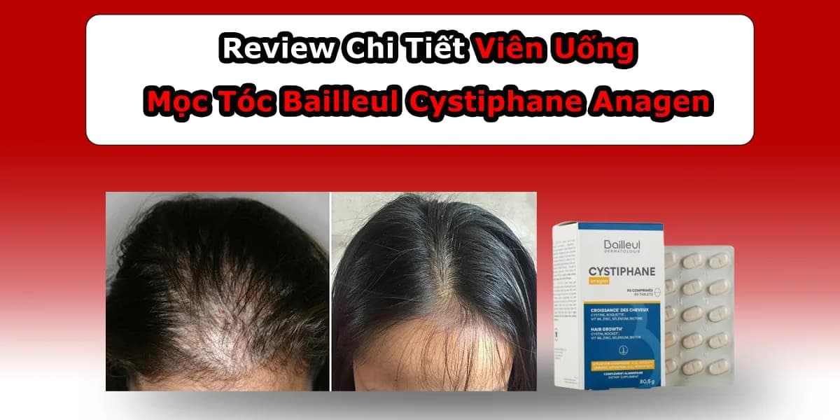Review Viên Uống Mọc Tóc Bailleul Cystiphane Anagen