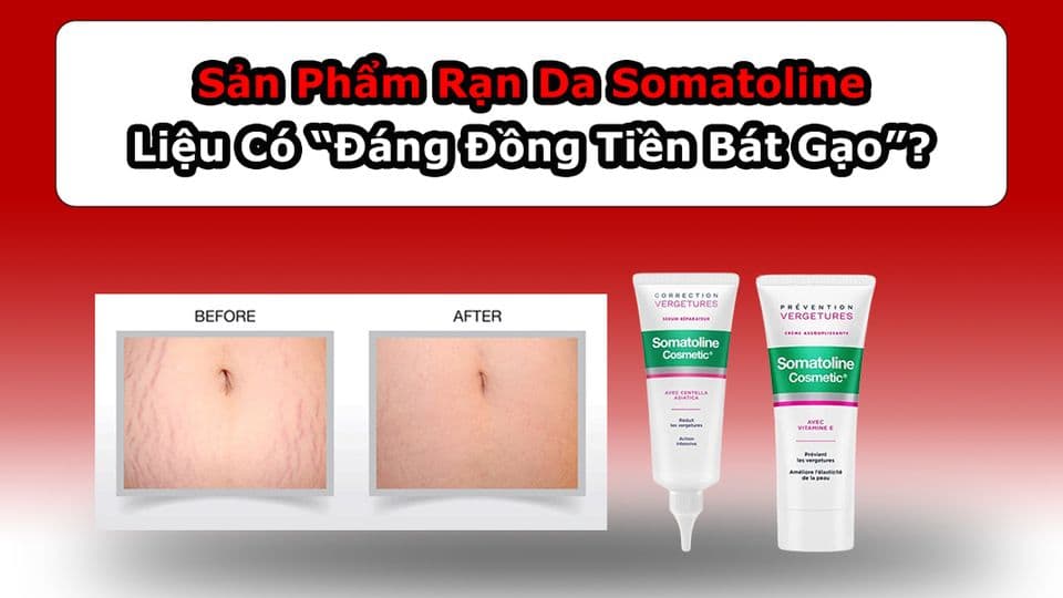 Sản Phẩm Rạn Da Somatoline Có “Đáng Đồng Tiền Bát Gạo”?