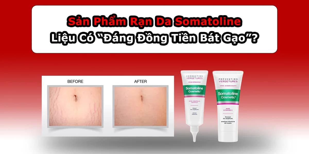 Sản Phẩm Rạn Da Somatoline Có “Đáng Đồng Tiền Bát Gạo”?
