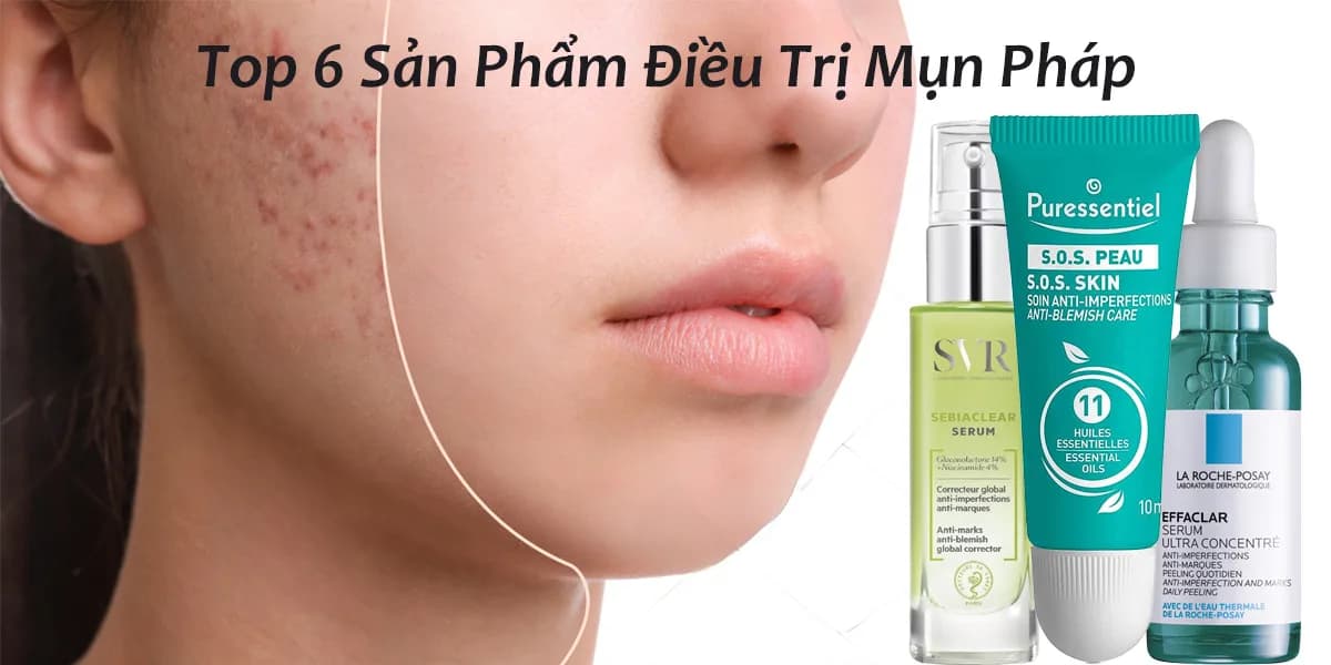 Top 6 Các Sản Phẩm Điều Trị Mụn Của Pháp Tốt Nhất