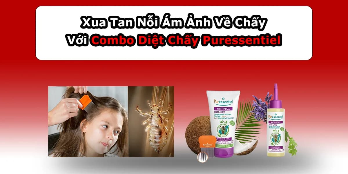 Diệt Chấy Puressentiel – Xua Tan Ám Ảnh Về Chấy Với