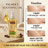 Dầu Dưỡng Thể Palmer's Cocoa Butter Formula Soothing Oil – Dầu Dưỡng Ẩm Da Khô Ngứa Cho Bà Bầu, Giảm Ngứa Rạn Da Từ Mỹ hiệu quả