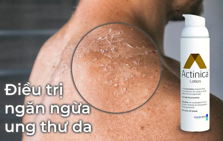 Đối tượng sử dụng Kem Dưỡng Da Chống Nắng Ngăn Ngừa Ung Thư Da Đầu Tiên ACTINICA Lotion