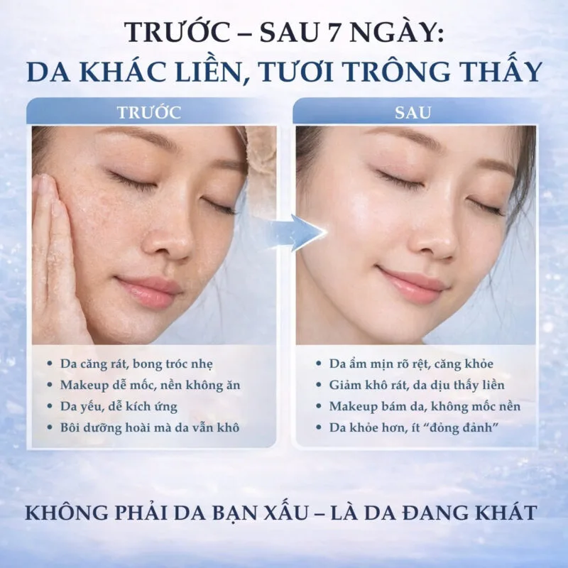Hiệu quả cấp ẩm của SVR B3 Ampoule Hydra