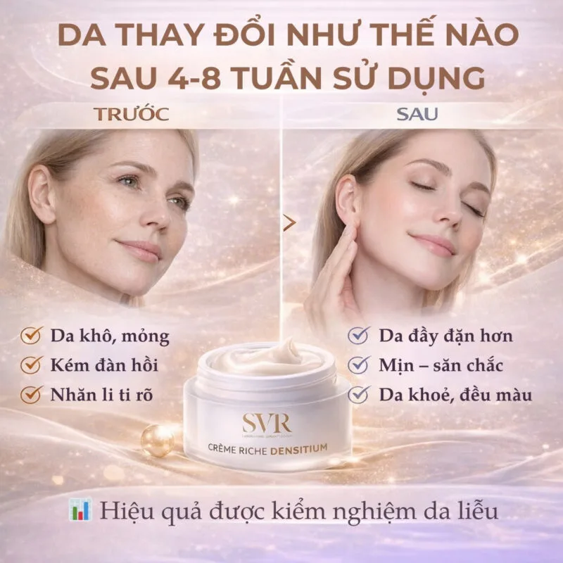 Hiệu Quả Kem Chống Lão Hóa SVR Densitium Crème Riche