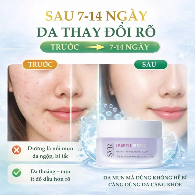 Hiệu Quả Khi Sử Dụng Kem Dưỡng Kiềm Dầu SVR Pepti Biotic Dành Cho Ai
