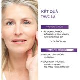 Kem Dưỡng Chống Lão Hóa Ban Đêm Loreal Age Perfect