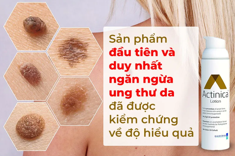 Kem Dưỡng Da Chống Nắng Ngăn Ngừa Ung Thư Da Đầu Tiên ACTINICA Lotion