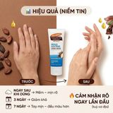 Kem Dưỡng Tay Palmer's Cocoa Butter Formula Heals & Softens – Kem Dưỡng Ẩm Sâu Da Tay Khô Nứt Nẻ, Làm Mềm Da Từ Mỹ hiệu quả