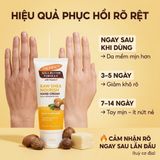 Kem Dưỡng Tay Palmer's Raw Shea Nourish Hand Cream – Kem Dưỡng Ẩm Sâu Da Tay Khô Nứt Nẻ, Bổ Sung Vitamin E Từ Mỹ hiệu quả