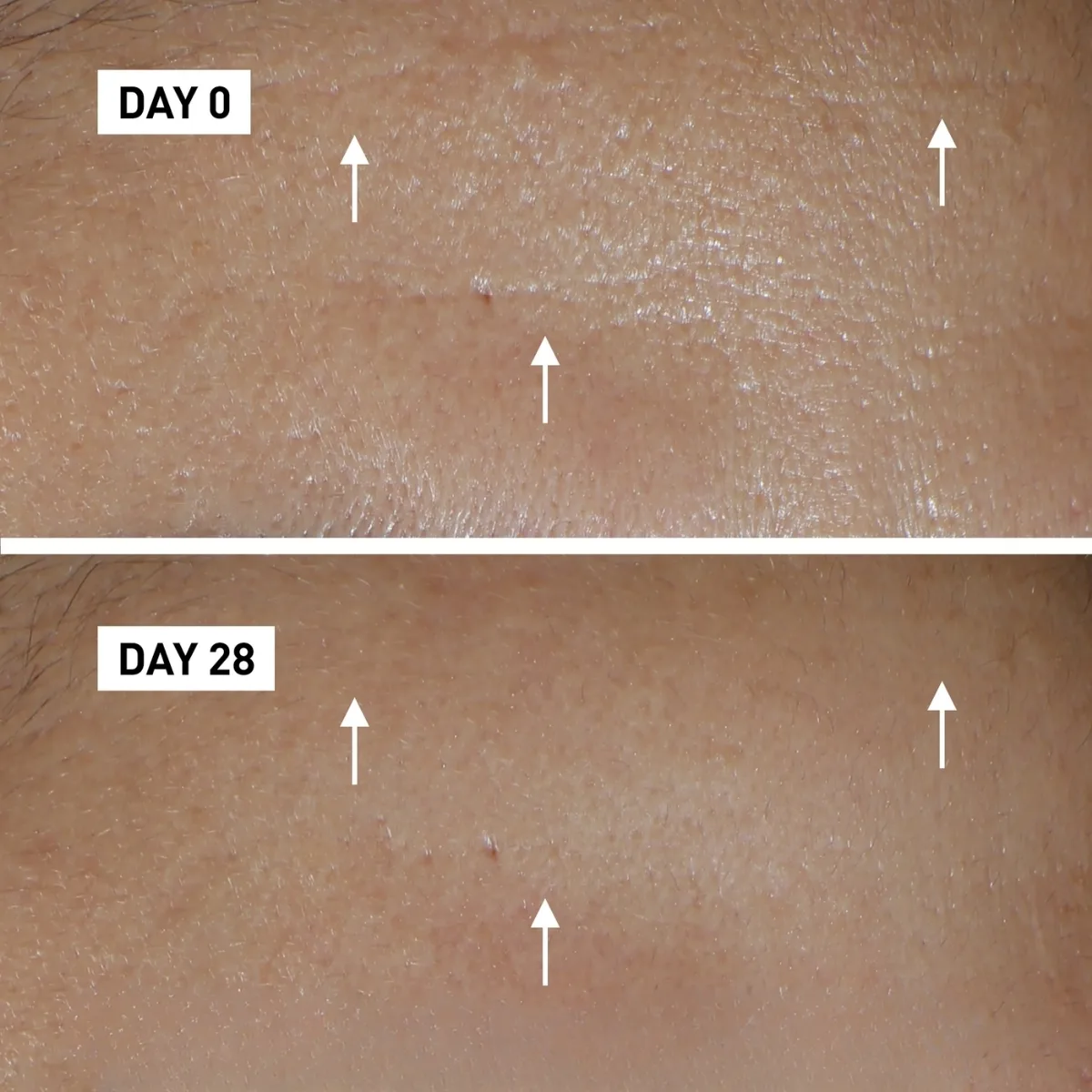 Kết quả sau 28 ngày sử dụng Serum Chống Lão Filorga HYDRA AOX 5 30ml, Chuyên Sâu