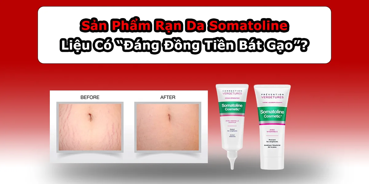Sản Phẩm Rạn Da Somatoline Có 