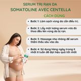 Serum Trị Rạn Da Somatoline Avec Centella