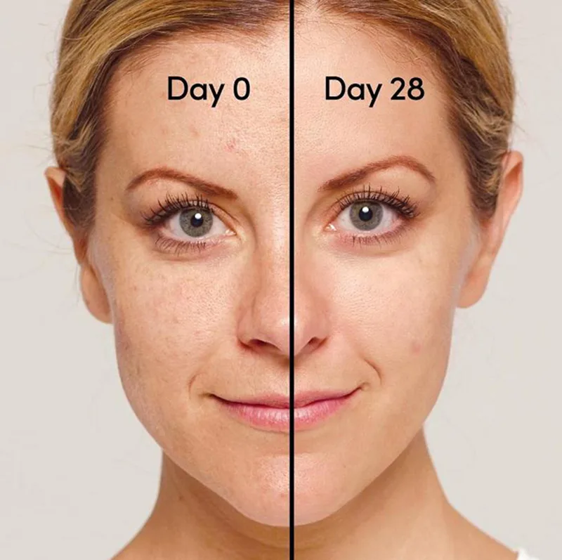 Kết hợp Filorga Hydra-AOX 5 với retinol trong chu trình chống lão hóa
