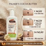 Sữa Dưỡng Thể Palmer's Cocoa Butter Massage Lotion – Kem Ngừa Rạn Da Cho Bà Bầu & Dưỡng Ẩm Sâu Da Khô hiệu quả