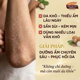 Sữa Dưỡng Thể Palmer's Raw Shea Nourish Daily Body Lotion – Kem Dưỡng Ẩm Sâu 48 Giờ Cho Da Khô Nhạy Cảm Từ Mỹ công dụng