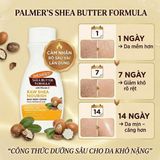 Sữa Dưỡng Thể Palmer's Raw Shea Nourish Daily Body Lotion – Kem Dưỡng Ẩm Sâu 48 Giờ Cho Da Khô Nhạy Cảm Từ Mỹ hiệu quả
