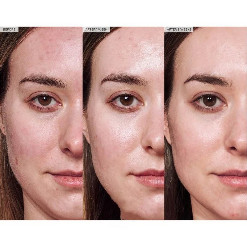 Công dụng Dưỡng ẩm La Roche Posay B5