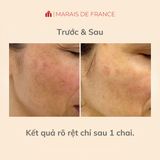 Tinh Chất Mờ Nám Isdin Brighten Melaclear Serum 30ml