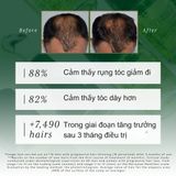Tinh Chất Mọc Tóc Rene Furterer Triphasic Progressive
