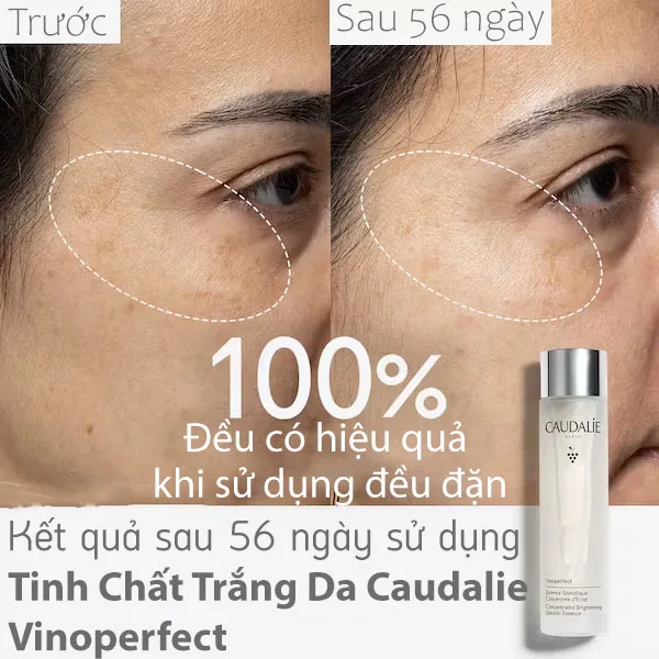 Tinh Chất Trắng Da Caudalie Vinoperfect 100ml