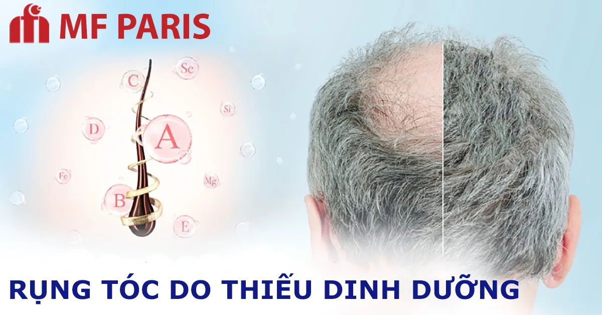 Dinh dưỡng và sức khỏe mái tóc