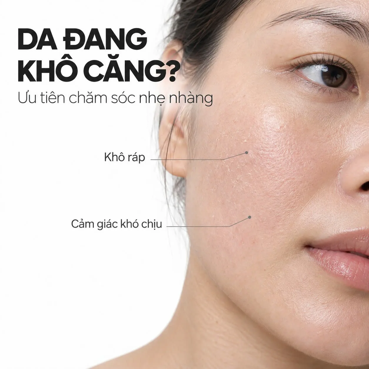 Toskani Total Recovery Gel chăm sóc da khô nhạy cảm và da cần phục hồi
