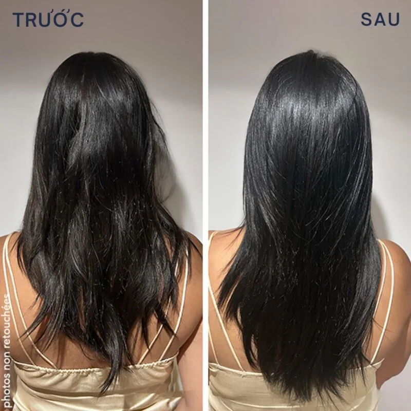 Trước và sau khi sử dụng Viên Uống Mọc Tóc Phyto Phanere