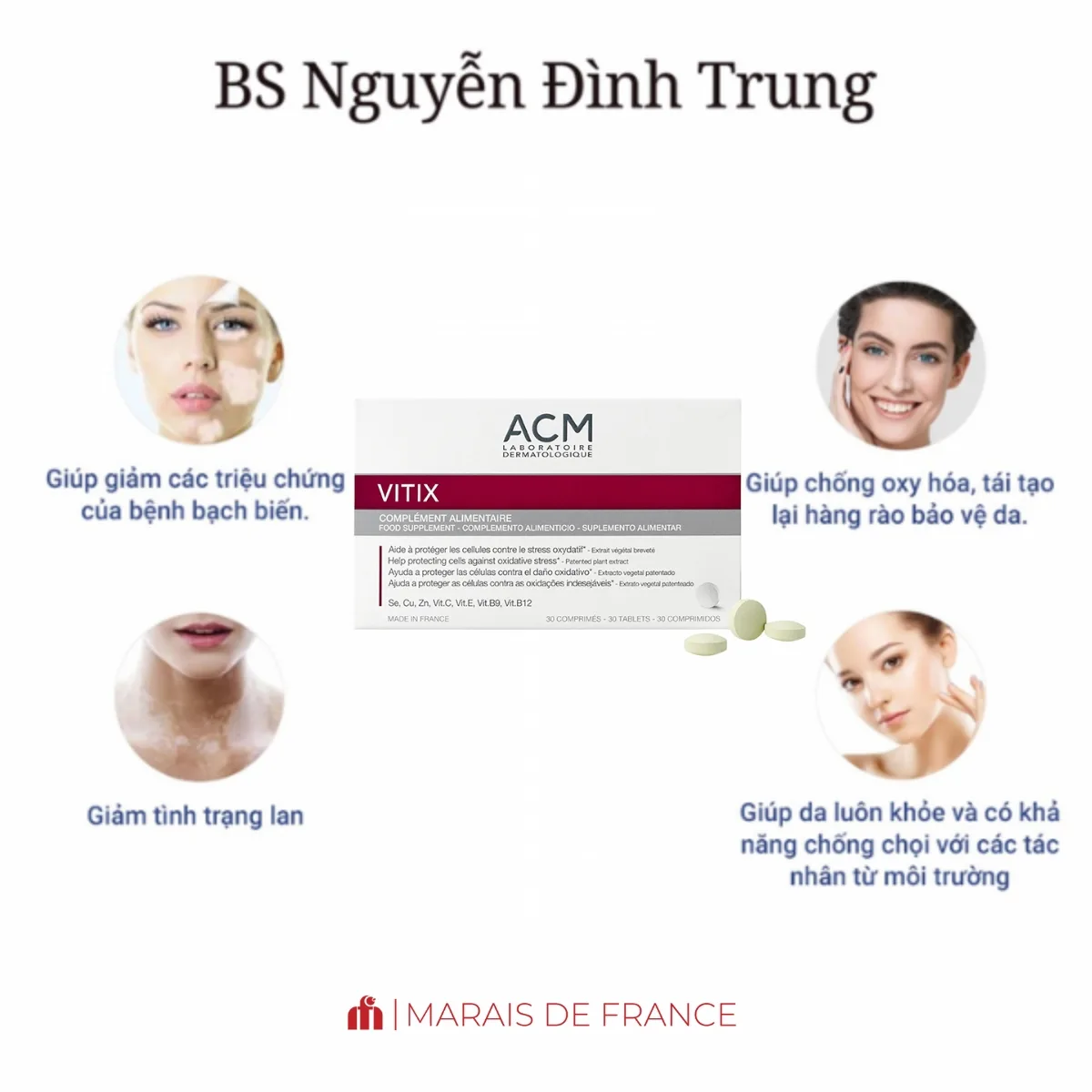 Viên Uống Bạch Biến ACM Vitix
