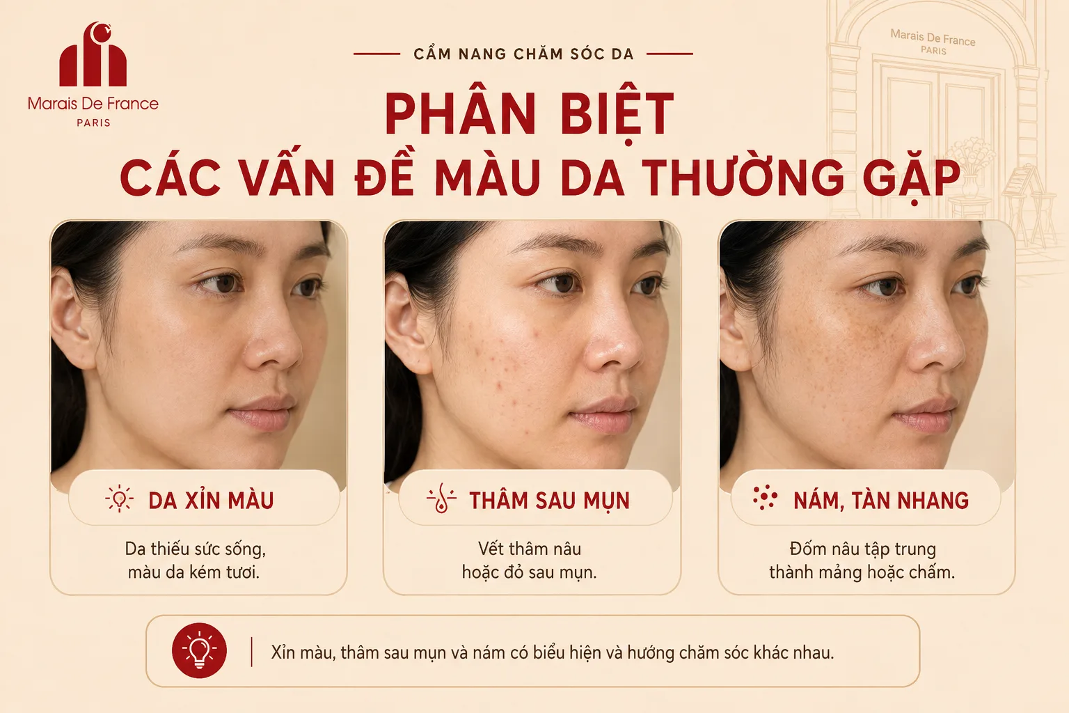Phân biệt da xỉn màu, thâm sau mụn và nám trên khuôn mặt